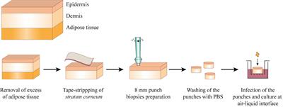 Virulence Gene Expression of Staphylococcus aureus in Human Skin